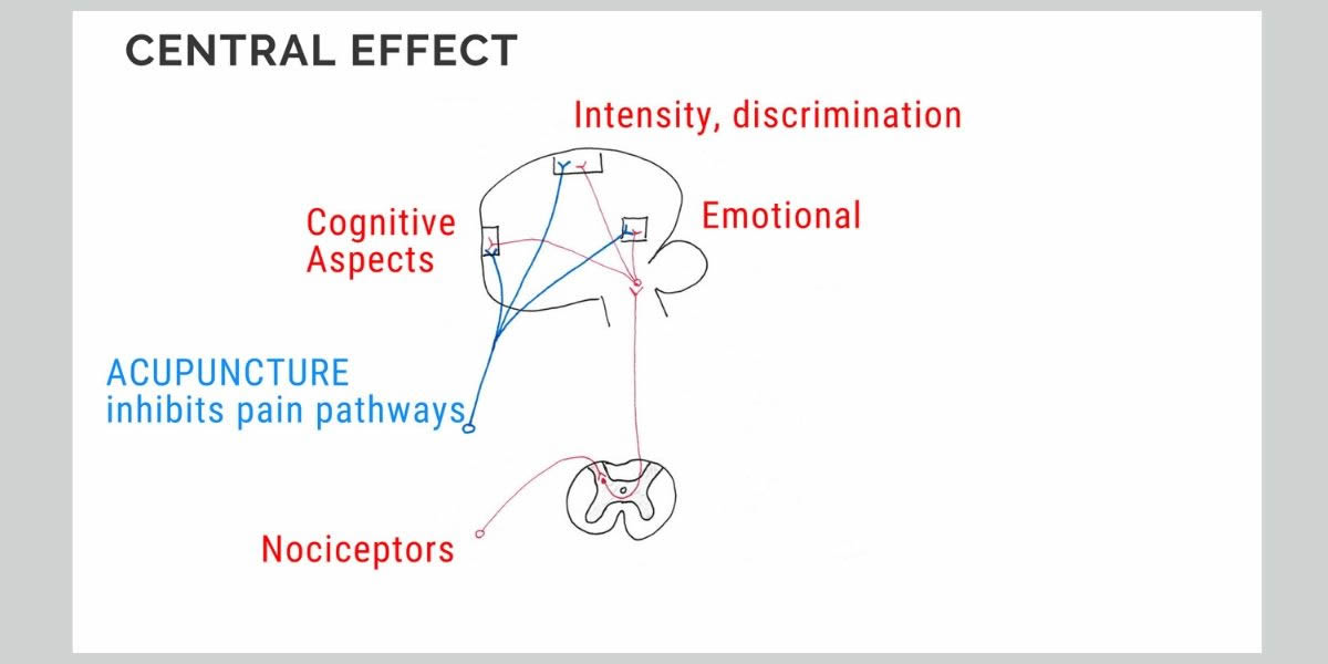 Acupuncture Explained - Tell me more - General effect